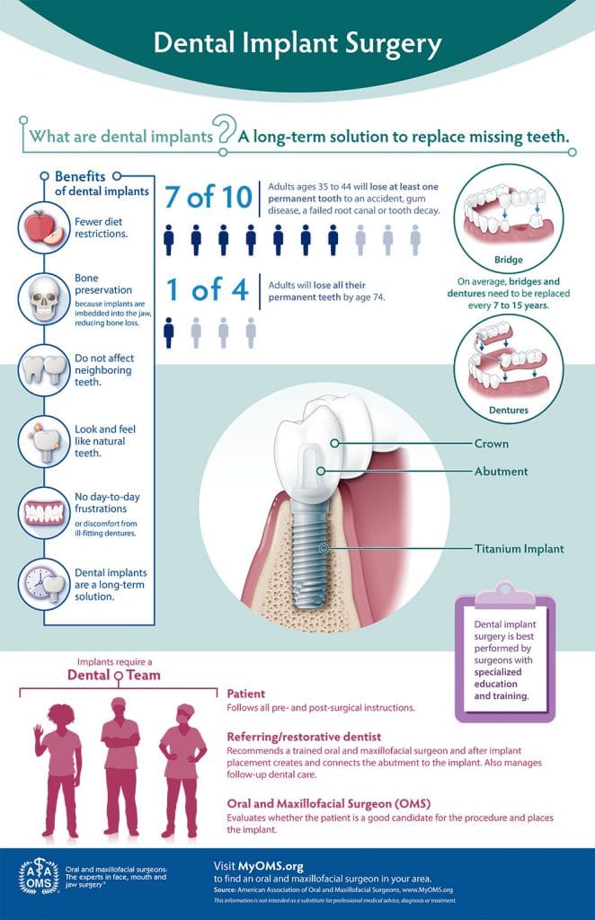 Dental Filling Pre-Operative Instructions