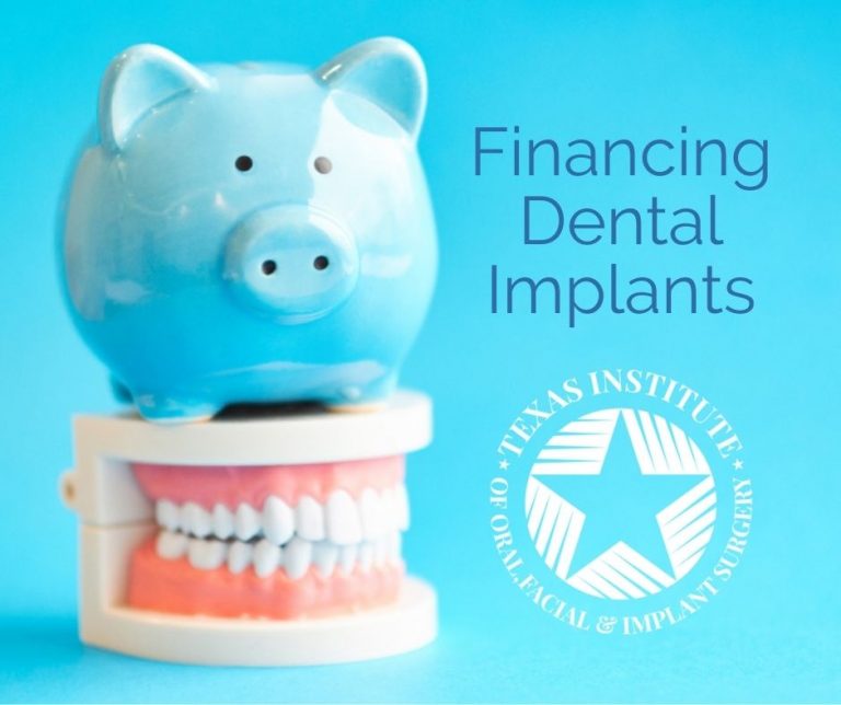 Simple Tips for Financing Dental Implants Midlothian, TX