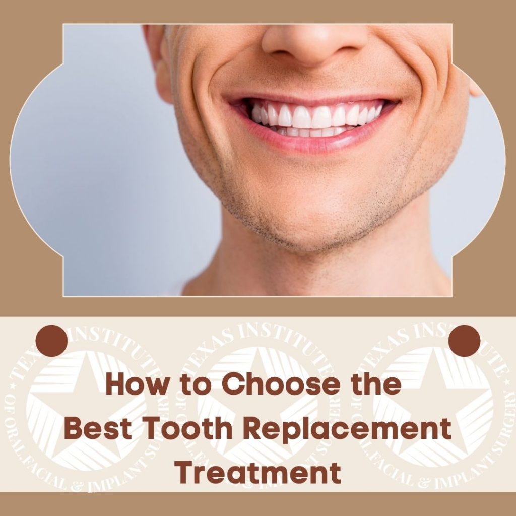 Tooth replacement Dallas Midlothian Waxahachie