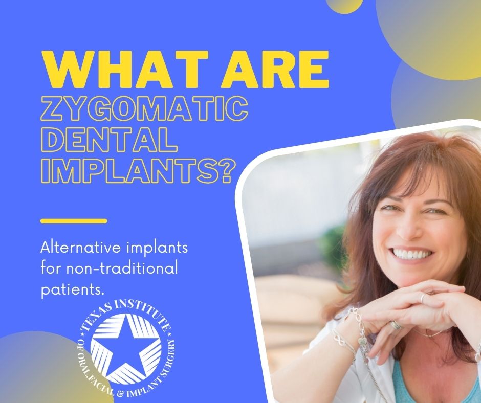 zygomatic implants midlothian