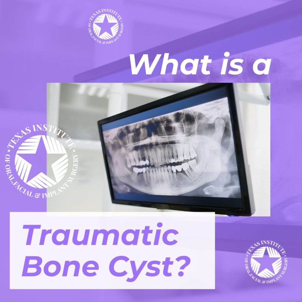 bone cyst surgery