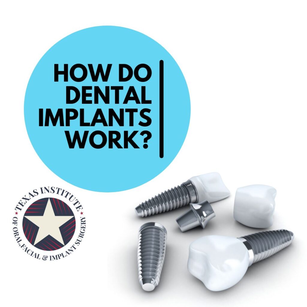 how dental implants work