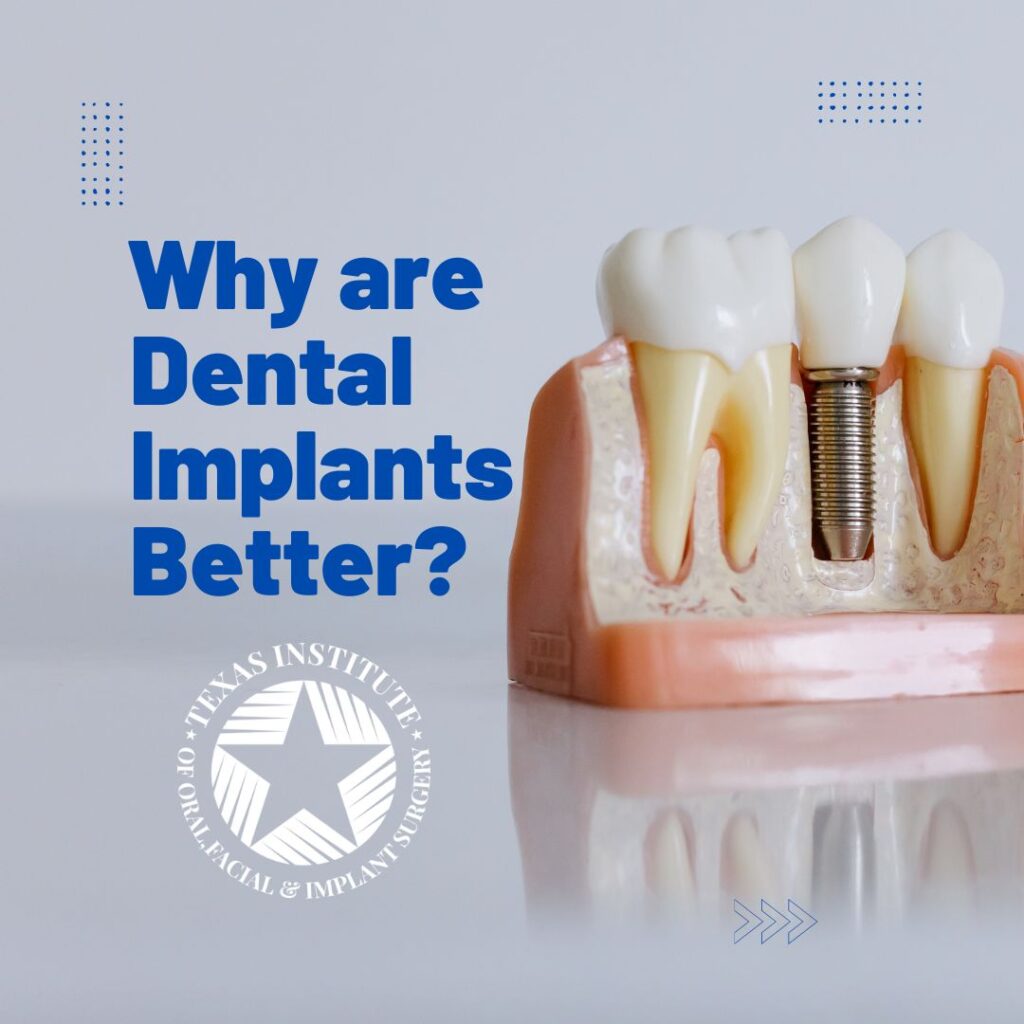 implants are better than bridges and dentures