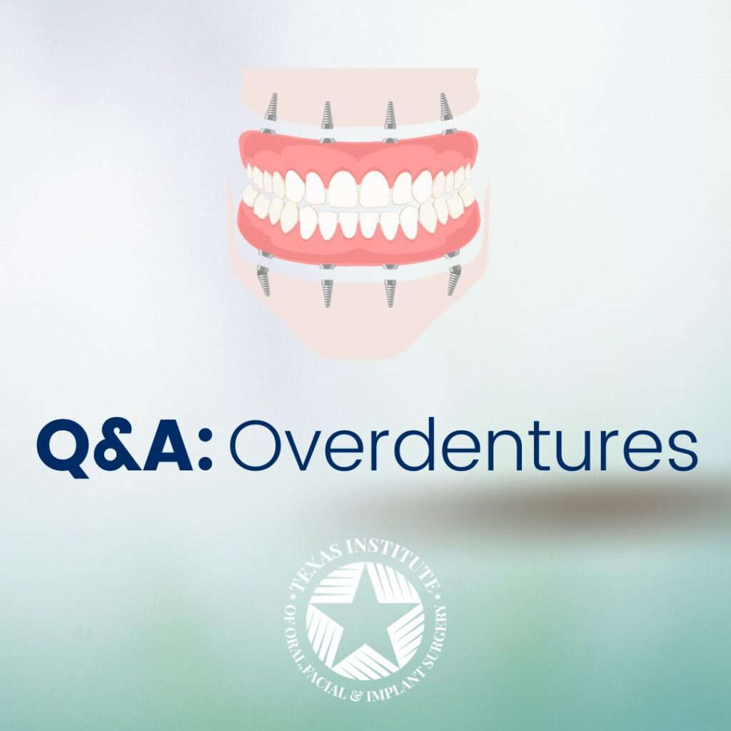 overdentures