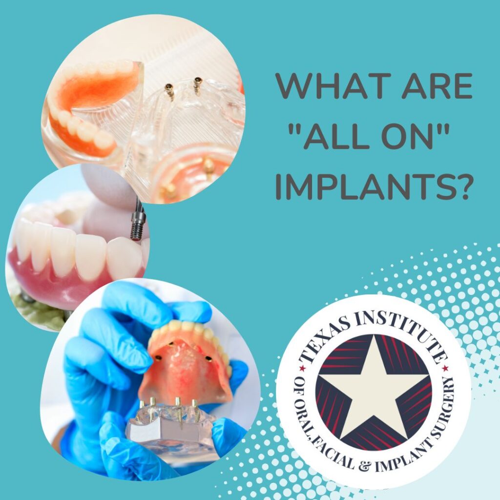 All-on-X implants