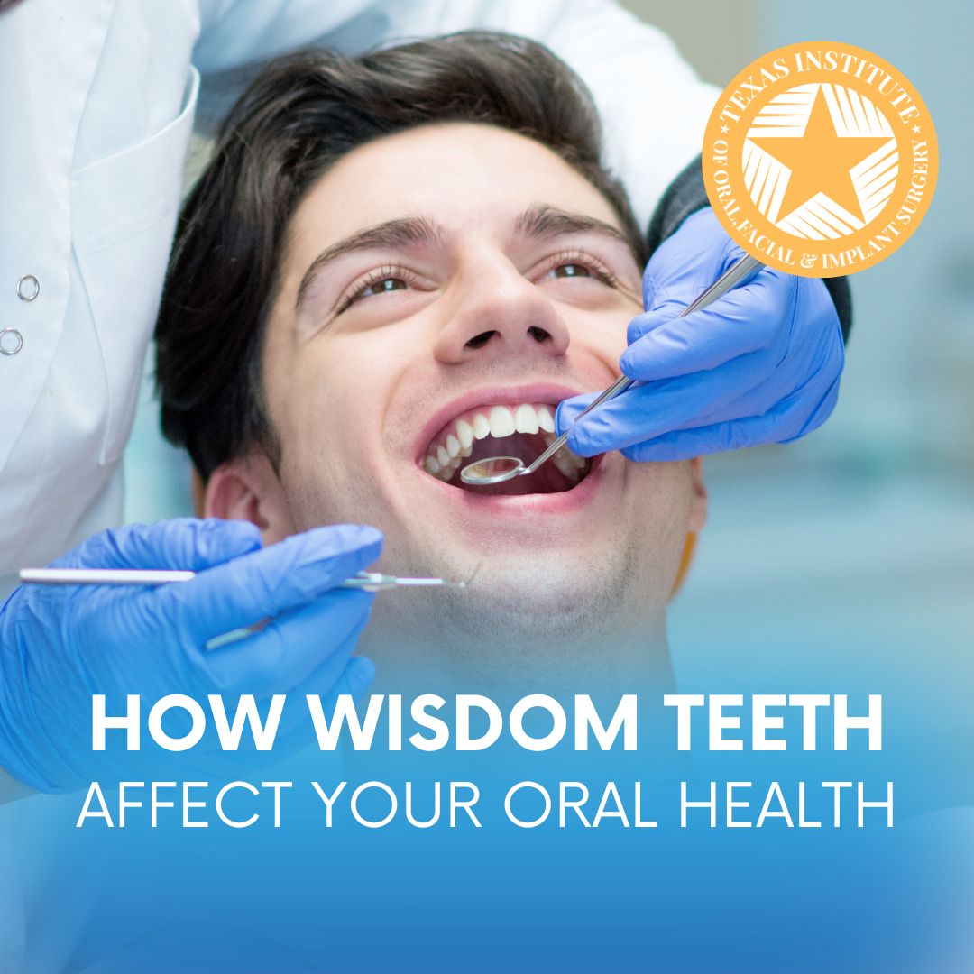 How Wisdom Teeth Affect Your Oral Health Midlothian, TX