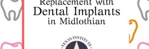 single tooth implants midlothian
