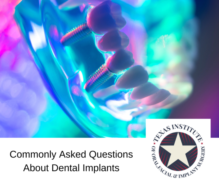 Commonly Asked Questions About Dental Implants - Texas Institute of ...