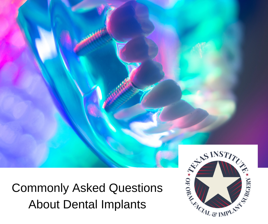 Commonly Asked Questions About Dental Implants